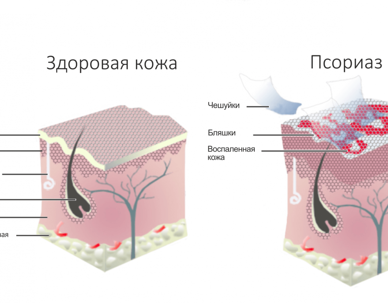 Доровая